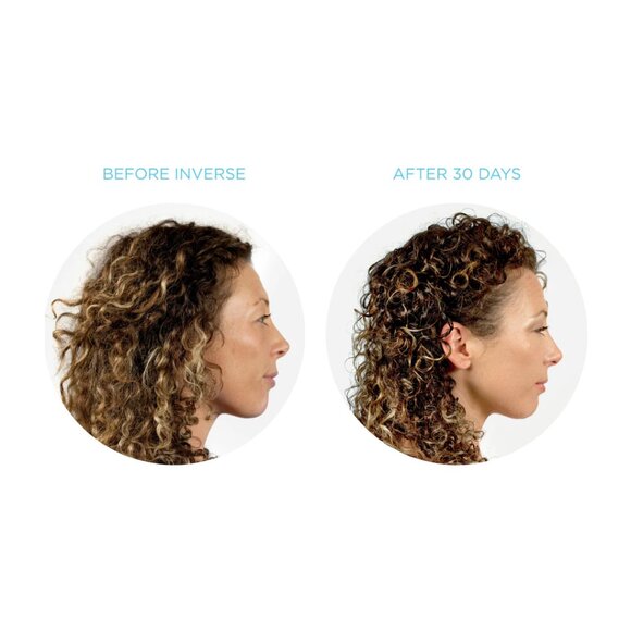 Inverse Hair Conditioning Device - Picture 5 of 5